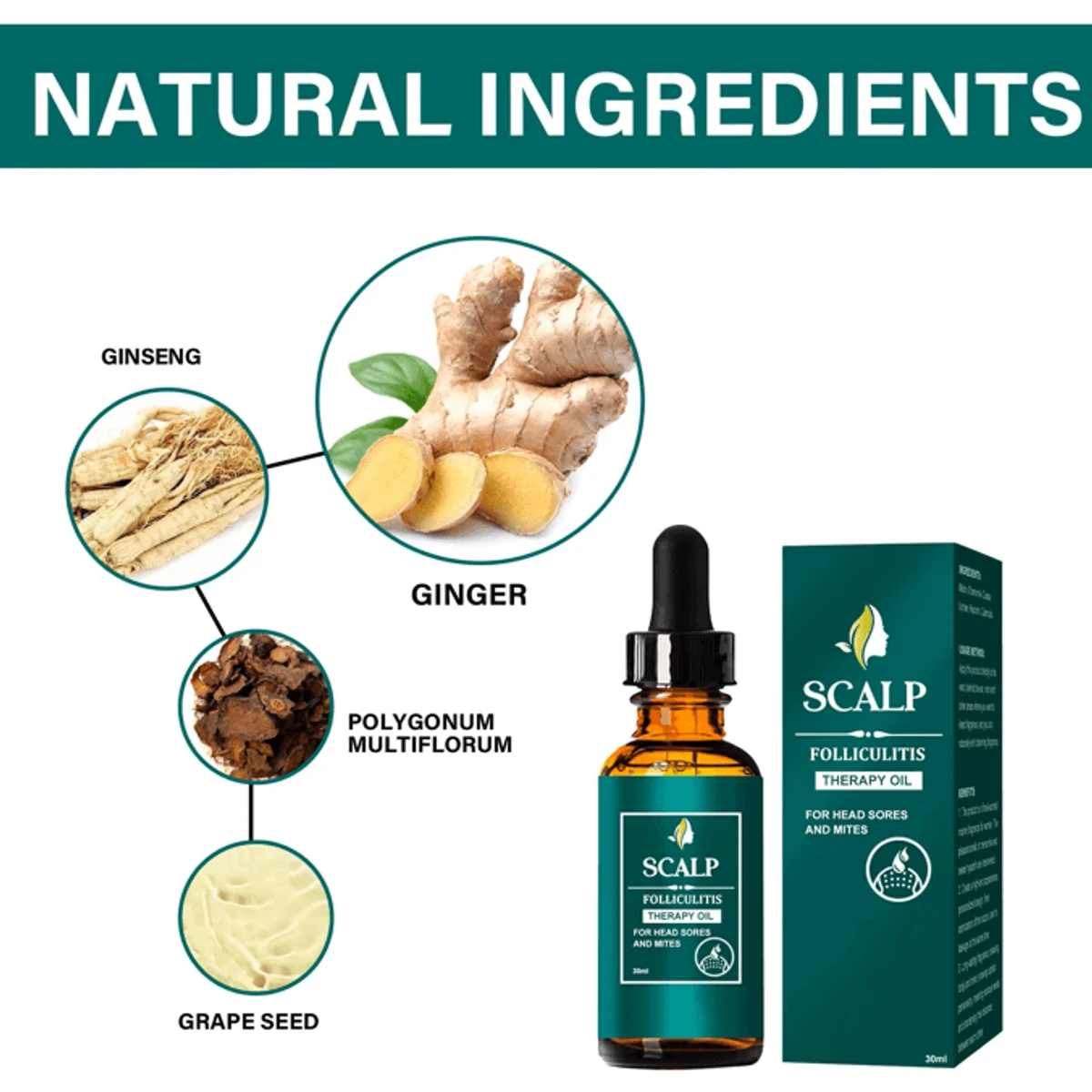 Fast Hair GrowtOil Ginger Growth Hair Treatment Anti Hair Loss Men Women Scalp Treatment Deeply Clean Hair Lice, Dirt.